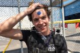 A newly licensed skydiver wearing his skydiving rig proudly pulls back his bangs to display his A license stamp on his forhead